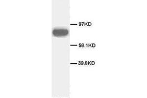 Western blot analysis of rat spleen sections using CD71 antibody (Transferrin Receptor 抗体  (C-Term))
