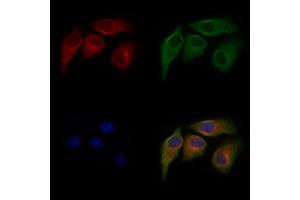 ABIN6264766 and ABIN6277226 staining Hela cells by IF/ICC. (RIPK2 抗体  (N-Term))