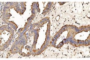 IHC analysis of PDIA6 using anti-PDIA6 antibody (ABIN7600554). (PDIA6 抗体  (AA 20-440))