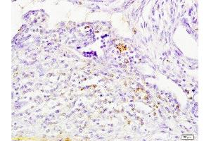Immunohistochemistry (Paraffin-embedded Sections) (IHC (p)) image for anti-Cathepsin H (CTSH) (AA 71-170) antibody (ABIN732758)
