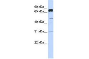 Image no. 1 for anti-Pleckstrin Homology Domain Containing, Family A (phosphoinositide Binding Specific) Member 4 (PLEKHA4) (AA 504-553) antibody (ABIN6740774) (PLEKHA4 抗体  (AA 504-553))