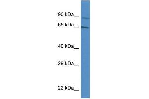 WB Suggested Anti-MUS81 AntibodyTitration: 1. (MUS81 抗体  (Middle Region))