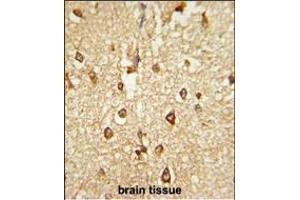 Formalin-fixed and paraffin-embedded human brain tissue reacted with DLX2 Antibody (Center), which was peroxidase-conjugated to the secondary antibody, followed by DAB staining. (DLX2 抗体  (AA 194-222))