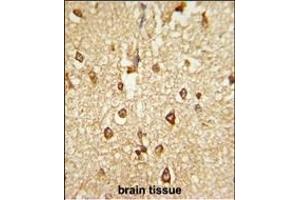 Formalin-fixed and paraffin-embedded human brain tissue reacted with DLX2 Antibody (Center), which was peroxidase-conjugated to the secondary antibody, followed by DAB staining. (DLX2 抗体  (AA 194-222))