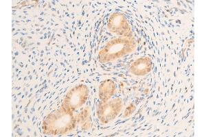 Immunohistochemistry (IHC) image for anti-Mitogen-Activated Protein Kinase Kinase Kinase 7 (MAP3K7) (pThr187) antibody (ABIN6256492)