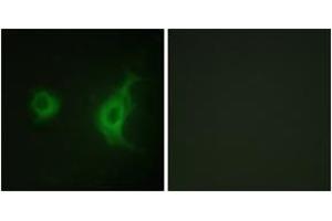 Immunofluorescence (IF) image for anti-Kinesin Family Member 20A (KIF20A) (AA 501-550) antibody (ABIN2888893) (KIF20A 抗体  (AA 501-550))