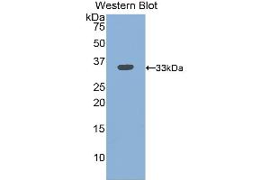 Detection of Recombinant ITGb3, Mouse using Polyclonal Antibody to Integrin Beta 3 (ITGb3) (Integrin beta 3 抗体  (AA 134-376))