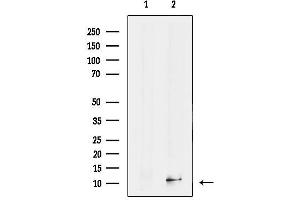 anti-S100 Calcium Binding Protein A14 (S100A14) (N-Term) antibody