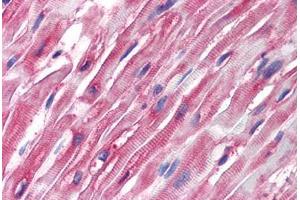 Human Heart (formalin-fixed, paraffin-embedded) stained with Tubulin, Alpha 1 (TUBA1) antibody ABIN239814 at 5 ug/ml followed by biotinylated anti-mouse IgG secondary antibody ABIN481714, alkaline phosphatase-streptavidin and chromogen. (alpha Tubulin 抗体)