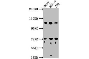Western Blot Positive WB detected in: 293T whole cell lysate, MCF-7 whole cell lysate, 293 whole cell lysate All lanes: WDR59 antibody at 1:2000 Secondary Goat polyclonal to rabbit IgG at 1/50000 dilution Predicted band size: 110, 65, 63, 47 kDa Observed band size: 110 kDa (WDR59 抗体  (AA 619-862))