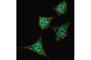 Fluorescent confocal image of HeLa cells stained with phospho-Bad-S99 antibody. (BAD 抗体  (pSer99))