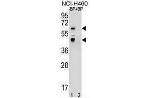 Western blot analysis of PRAMEF3 Antibody (C-term) Pab pre-incubated without(lane 1) and with(lane 2) blocking peptide in NCI-H460 cell line lysate. (PRAMEF3 抗体  (C-Term))
