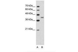 Image no. 1 for anti-Bradykinin Receptor B2 (BDKRB2) (N-Term) antibody (ABIN203497) (BDKRB2 抗体  (N-Term))