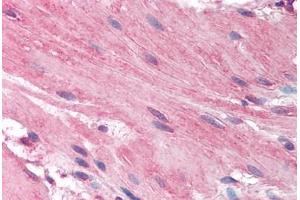 Human Small Intestine, Smooth Muscle (formalin-fixed, paraffin-embedded) stained with HRH1 antibody ABIN297157 at 2. (HRH1 抗体  (AA 471-484))