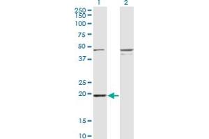 Western Blot analysis of RBBP9 expression in transfected 293T cell line by RBBP9 monoclonal antibody (M03A), clone 3H4. (RBBP9 抗体  (AA 1-186))
