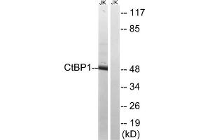 Western blot analysis of extracts from Jurkat cells, using CtBP1 (epitope around residue 422) antibody. (CTBP1 抗体  (Ser422))