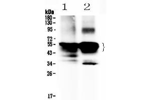 Western blot analysis of Retinal S antigen using anti-Retinal S antigen antibody . (SAG 抗体  (AA 193-405))
