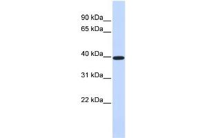 WB Suggested Anti-XRCC4 Antibody Titration:  0. (XRCC4 抗体  (Middle Region))