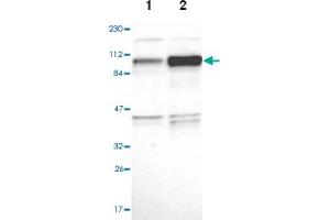 Western blot analysis of Lane 1: Human cell line RT-4, Lane 2: Human cell line U-251MG sp with NCAPH polyclonal antibody  at 1:100-1:250 dilution. (NCAPH 抗体)