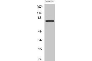 Western Blot (WB) analysis of COLO205 cells using EWS Polyclonal Antibody. (EWSR1 抗体  (Internal Region))