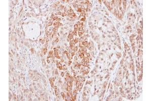 IHC-P Image Immunohistochemical analysis of paraffin-embedded A549 xenograft, using Kininogen 1, antibody at 1:500 dilution. (KNG1 抗体)