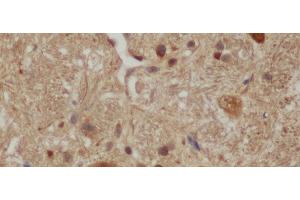 Immunohistochemistry of paraffin-embedded Mouse brain using Aβ40 Polyclonal Antibody at dilution of 1:50 (Abeta 1-40 抗体)
