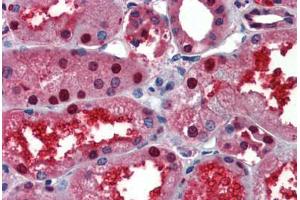 Human Kidney (formalin-fixed, paraffin-embedded) stained with LASS2 antibody ABIN462181 followed by biotinylated goat anti-rabbit IgG secondary antibody ABIN481713, alkaline phosphatase-streptavidin and chromogen. (Ceramide Synthase 2 抗体  (AA 72-121))