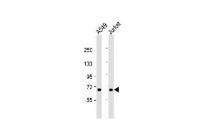 All lanes : Anti-F11 Antibody (Center) at 1:1000 dilution Lane 1: A549 whole cell lysate Lane 2: Jurkat whole cell lysate Lysates/proteins at 20 μg per lane. (Factor XI 抗体  (AA 281-307))