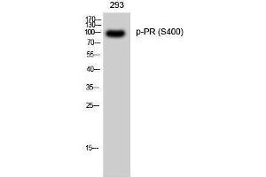 Western Blotting (WB) image for anti-PR (pSer400) antibody (ABIN3182420) (PR (pSer400) 抗体)
