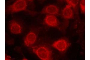 Immunofluorescence staining of methanol-fixed MCF cells using eIF4E(Phospho-Ser209) Antibody. (EIF4E 抗体  (pSer209))