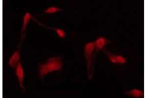 ABIN6266915 staining Hela by IF/ICC.