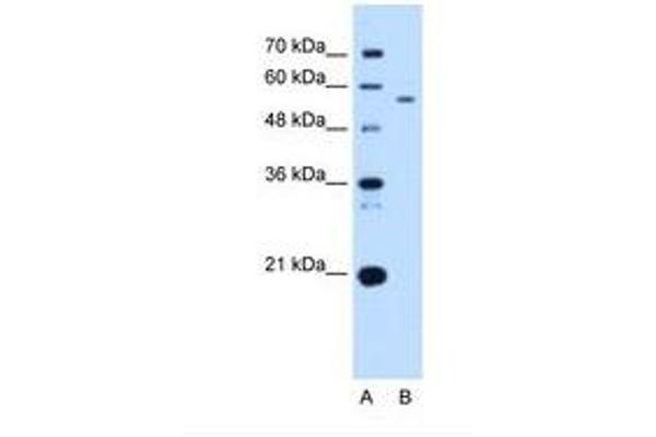 UBXD2 anticorps  (AA 301-350)