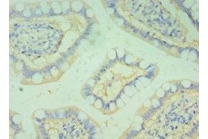 Immunohistochemistry of paraffin-embedded human small intestine tissue using ABIN7145826 at dilution of 1:100 (BOC 抗体  (AA 1-125))