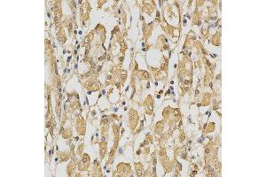Immunohistochemistry of paraffin-embedded human stomach using PRDX4 antibody at dilution of 1:200 (x400 lens) (Peroxiredoxin 4 抗体)