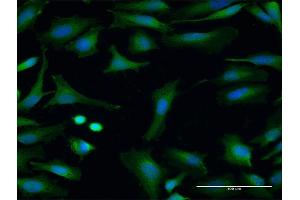 Immunofluorescence of purified MaxPab antibody to FMO3 on HeLa cell. (FMO3 抗体  (AA 1-532))