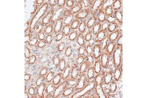 Immunohistochemistry (IHC) image for anti-Kinesin Family Member 4A (KIF4A) (AA 870-1080) antibody (ABIN6142873)