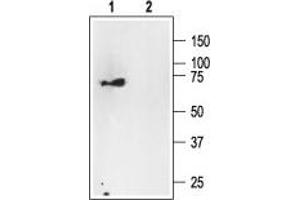 Western blot analysis of rat brain membranes: - 1. (NGFR 抗体  (Intracellular))