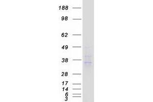 Western Blotting (WB) image for Chemokine Binding Protein 2 (CCBP2) protein (Myc-DYKDDDDK Tag) (ABIN2713275)