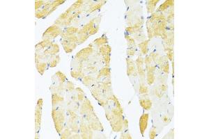 Immunohistochemistry of paraffin-embedded mouse heart using DDX3Y antibody (ABIN6130260, ABIN6139496, ABIN6139497 and ABIN6215395) at dilution of 1:100 (40x lens). (DDX3Y 抗体  (AA 1-210))
