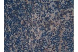 Immunohistochemistry (IHC) image for anti-Lectin, Galactoside-Binding, Soluble, 9 (LGALS9) (AA 225-353) antibody (ABIN7438190)