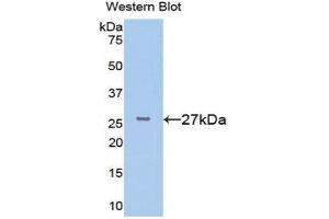 Western Blotting (WB) image for anti-FK506 Binding Protein 3, 25kDa (FKBP3) (AA 2-224) antibody (ABIN1078043) (FKBP3 抗体  (AA 2-224))