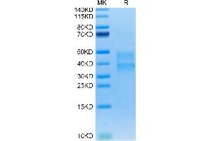 Mouse Clusterin on Tris-Bis PAGE under reduced condition. (Clusterin Protein (CLU) (AA 22-448) (His tag))