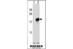 Western blot analysis of CMTM7 using rabbit polyclonal CMTM7 Antibody using 293 cell lysates (2 ug/lane) either nontransfected (Lane 1) or transiently transfected (Lane 2) with the CMTM7 gene. (CMTM7 抗体  (N-Term))