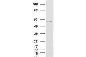 Western Blotting (WB) image for Karyopherin alpha 6 (Importin alpha 7) (KPNA6) protein (Myc-DYKDDDDK Tag) (ABIN2724408)