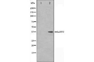 Western blot analysis on HuvEc cell lysate using hnRPD Antibody. (HNRNPD/AUF1 抗体  (Internal Region))