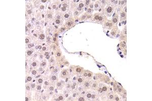 Immunohistochemistry of paraffin-embedded mouse liver using CDKN1A Antibody. (p21 抗体)