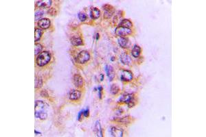 Immunohistochemistry (IHC) image for anti-Cytochrome P450, Family 4, Subfamily F, Polypeptide 2 (CYP4F2) (N-Term) antibody (ABIN7297402)