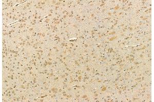 ABIN6260789 and ABIN6272910 at 1/100 staining Rat brain tissue by IHC-P. (CHCHD2 抗体  (Internal Region))
