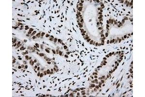 Image no. 8 for anti-Aryl Hydrocarbon Receptor Nuclear Translocator (ARNT) antibody (ABIN1496729) (ARNT 抗体)