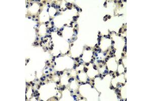 Immunohistochemistry (Paraffin-embedded Sections) (IHC (p)) image for anti-Proteasome (Prosome, Macropain) 26S Subunit, Non-ATPase, 13 (PSMD13) (AA 1-250) antibody (ABIN6146337)